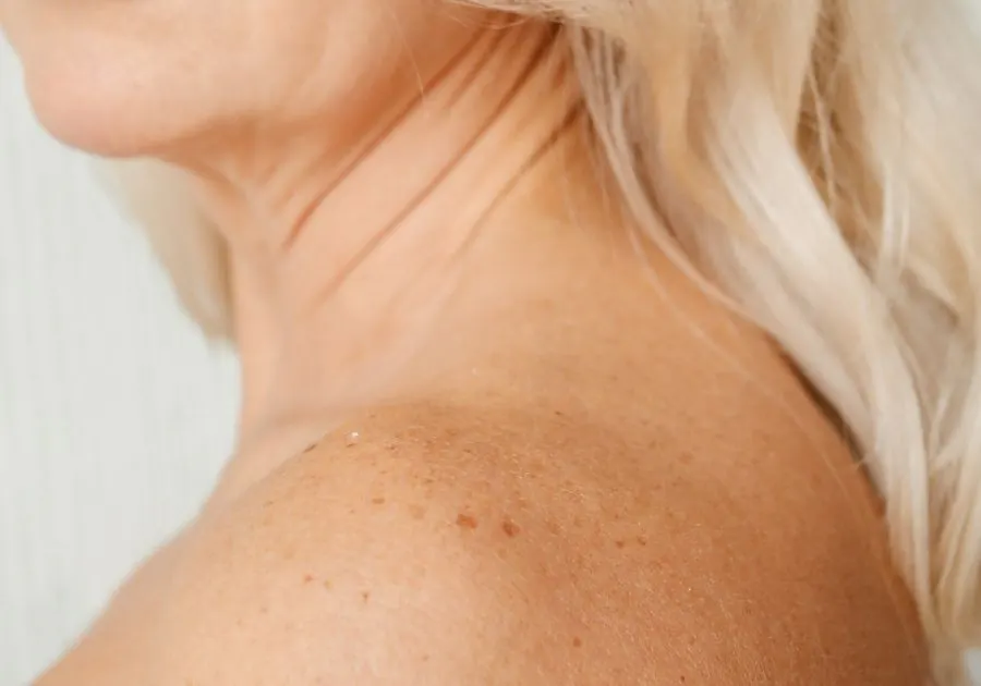Sagging Skin & Skin Laxity care at Revita Luxe Tampa