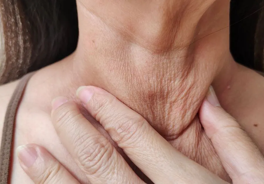 Sagging Skin and Skin Laxity — conditions we treat at Revita Luxe