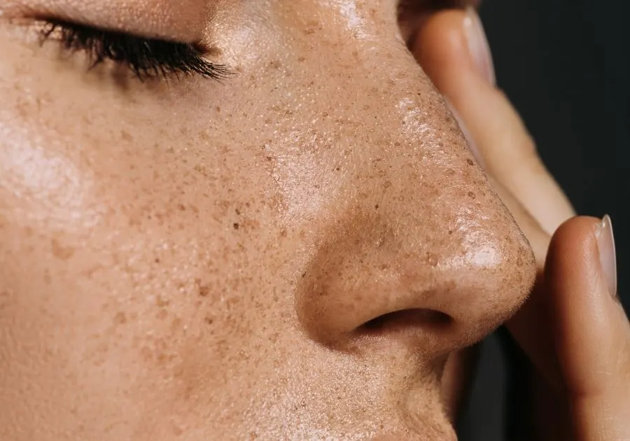Sun Damage & Uneven Skin Tone care at Revita Luxe Miami