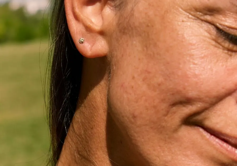 Wrinkles and Fine Lines — conditions we treat at Revita Luxe